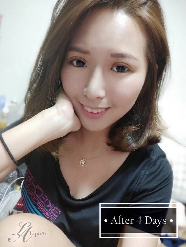 萊波亞