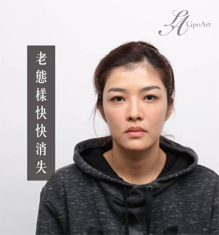 萊波亞