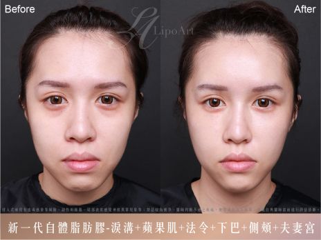萊波亞 