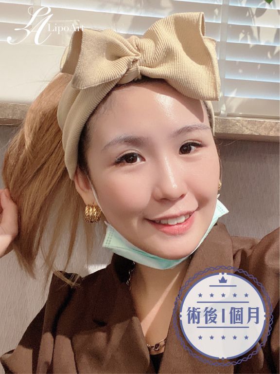 萊波亞