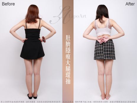 萊波亞 