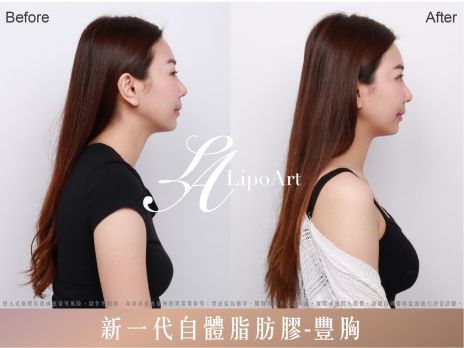 萊波亞 