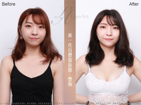 萊波亞 