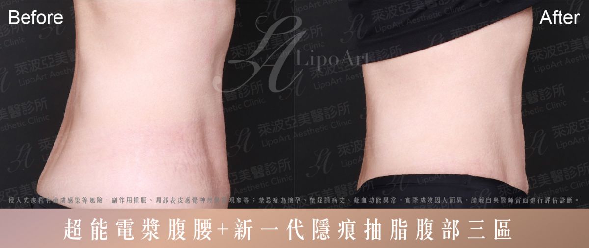 萊波亞