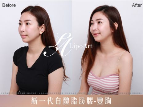 萊波亞 