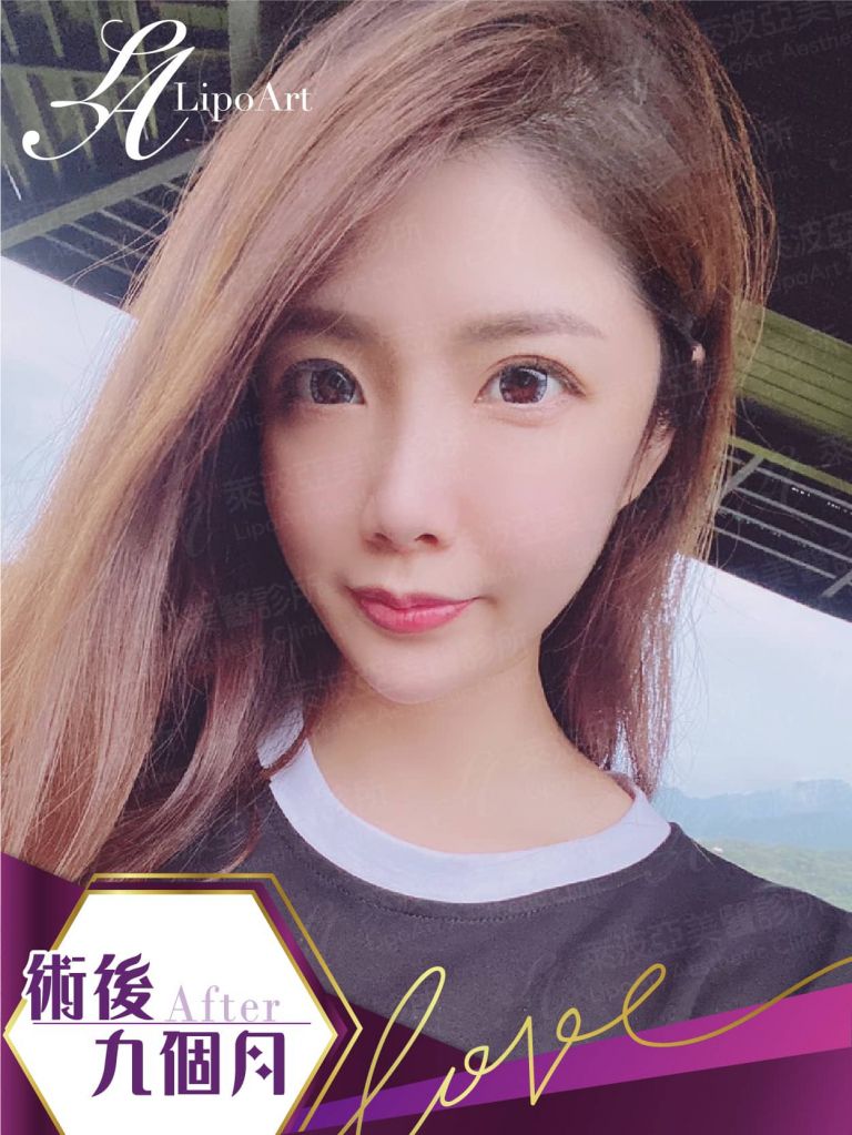 萊波亞