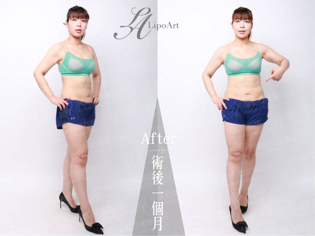 萊波亞