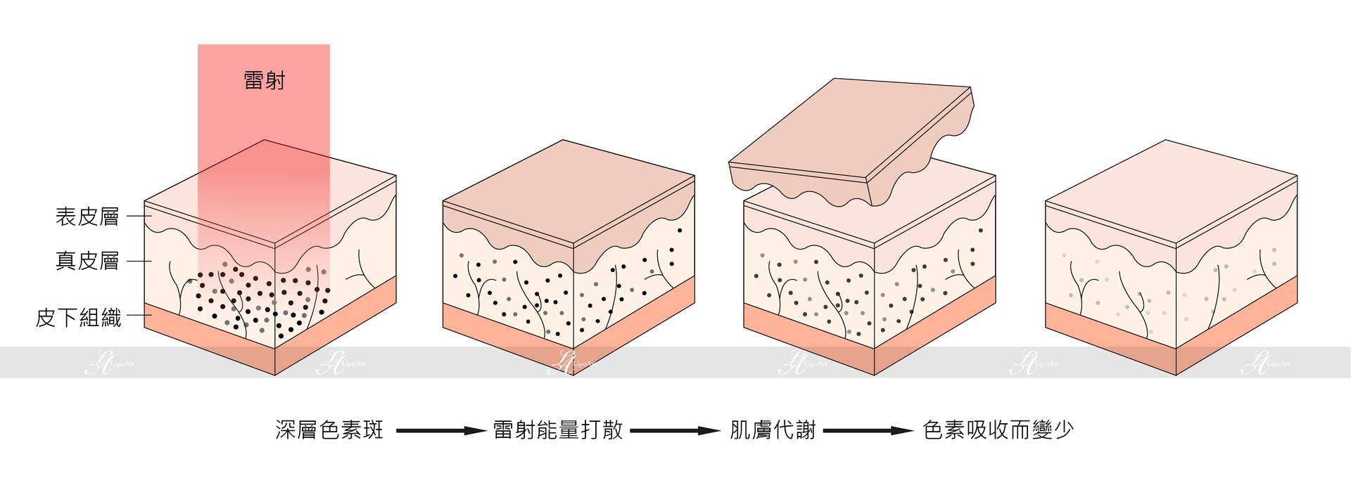 萊波亞