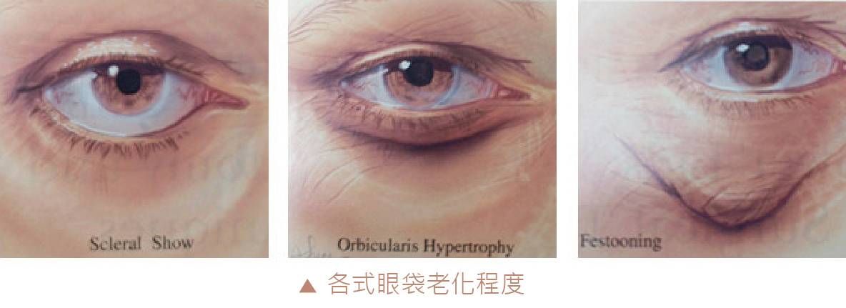 萊波亞