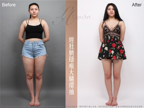 萊波亞 