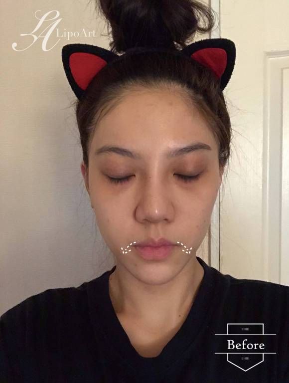 萊波亞