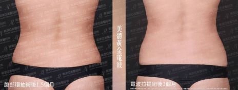 萊波亞 