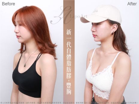 萊波亞 