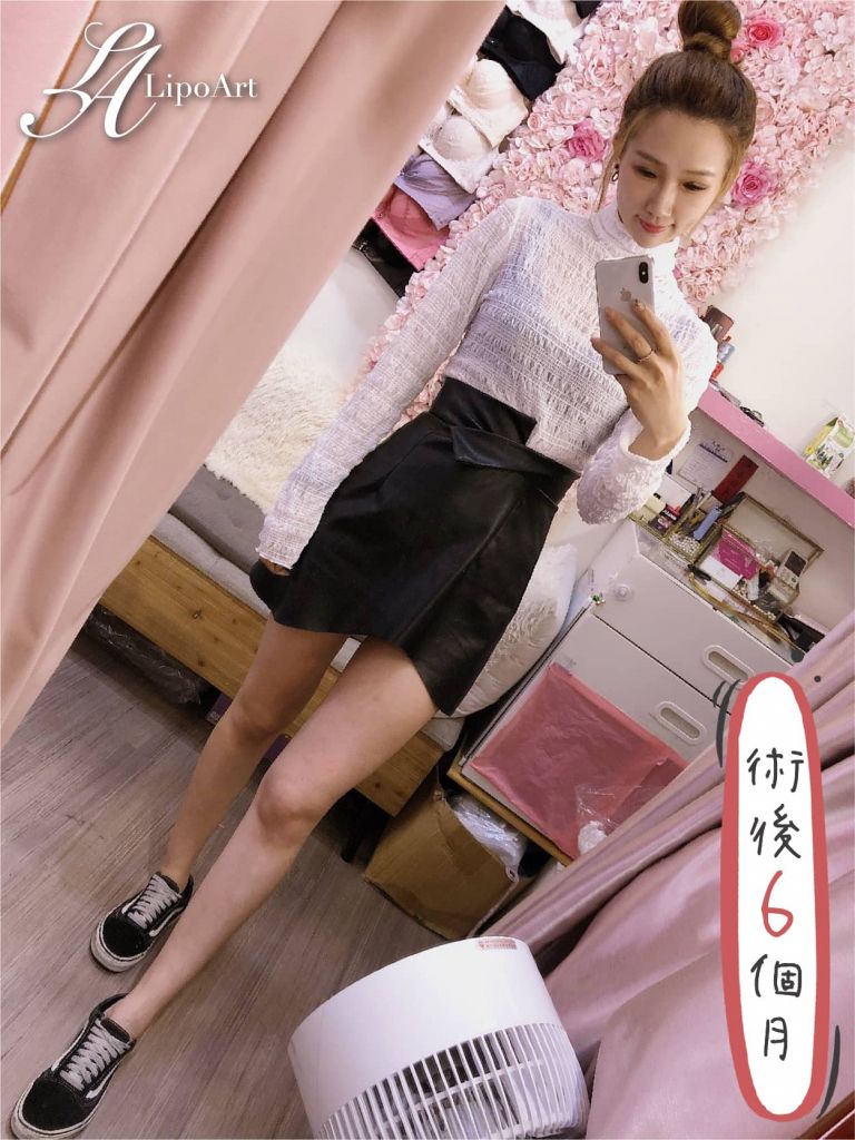 萊波亞