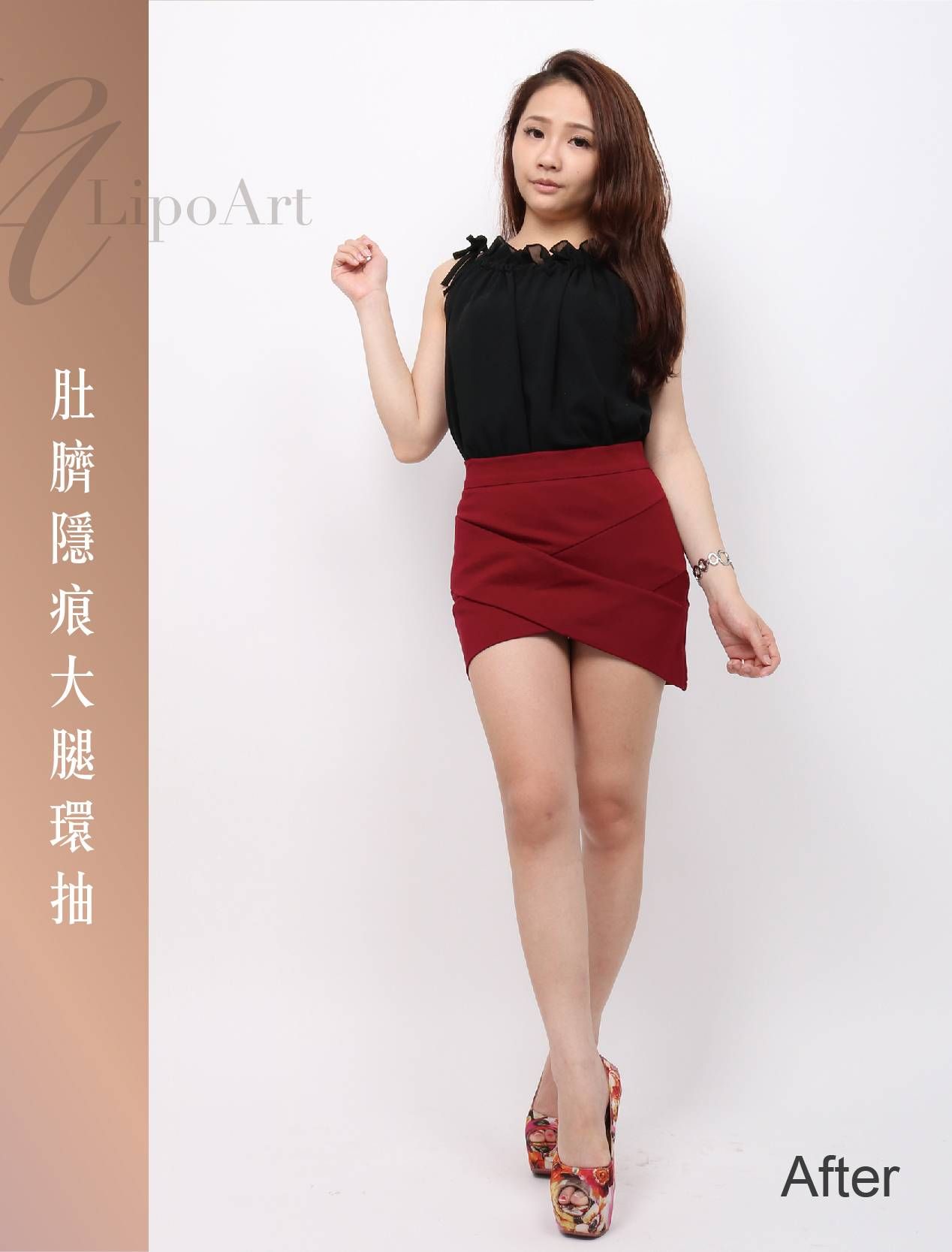 萊波亞 