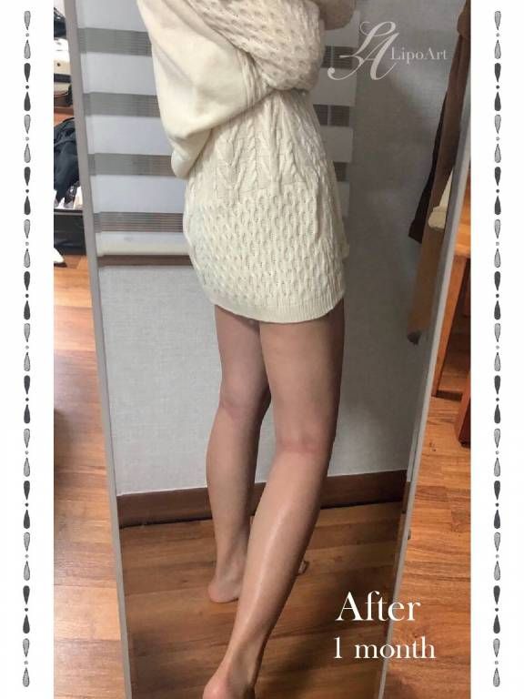 萊波亞