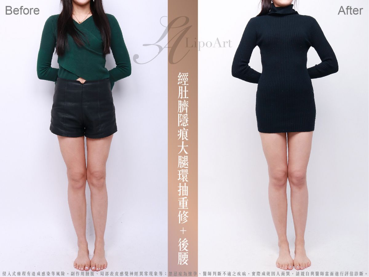 萊波亞