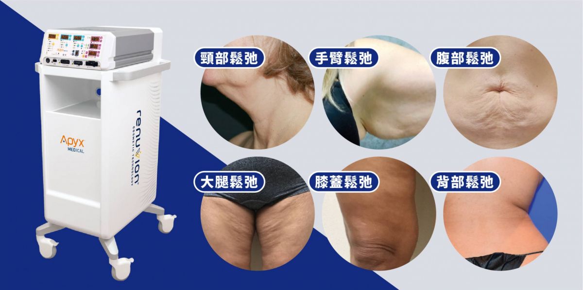 萊波亞