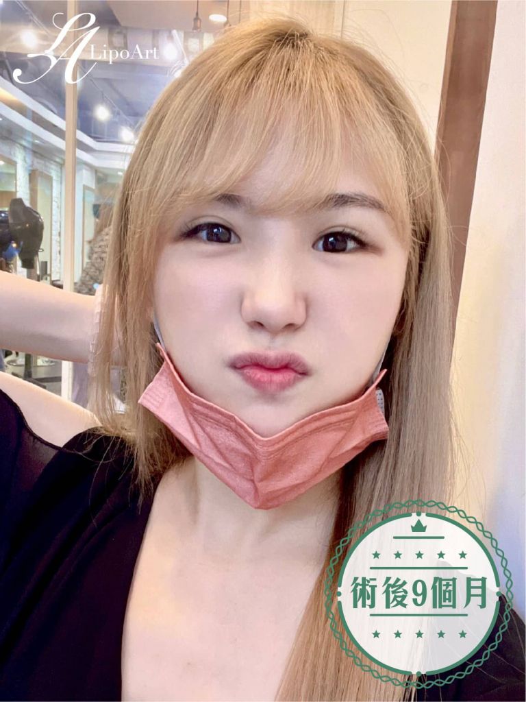 萊波亞