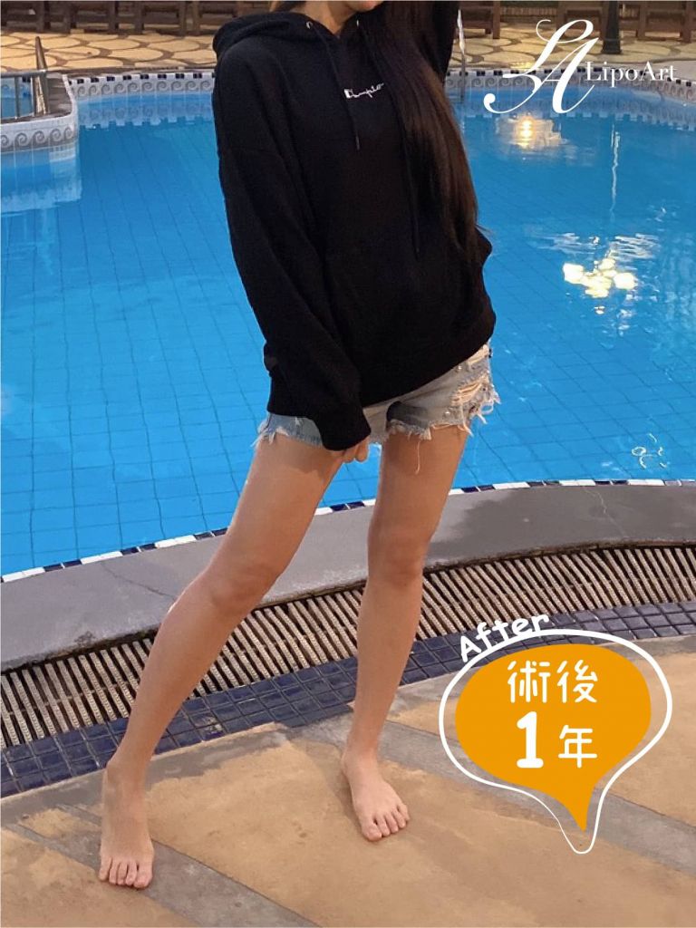 萊波亞