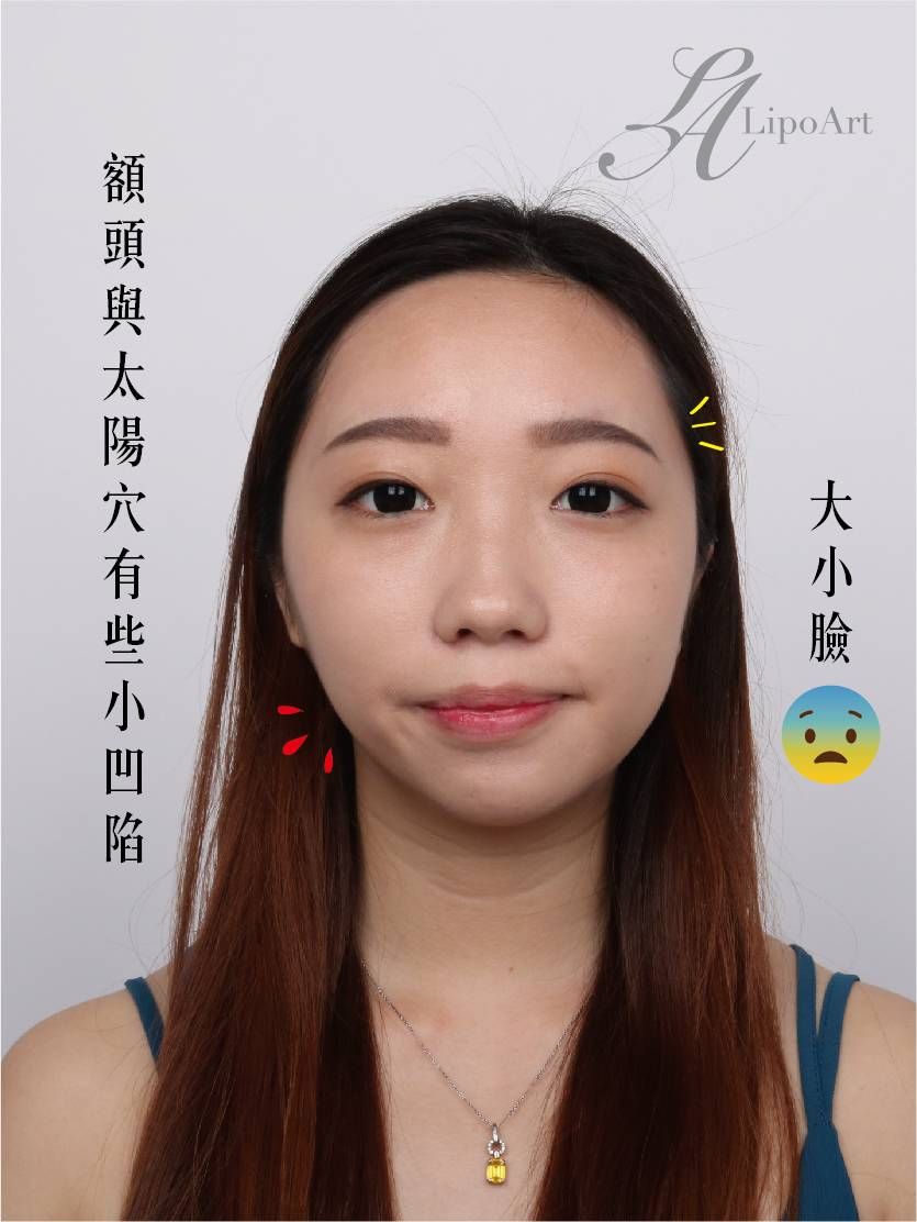 萊波亞