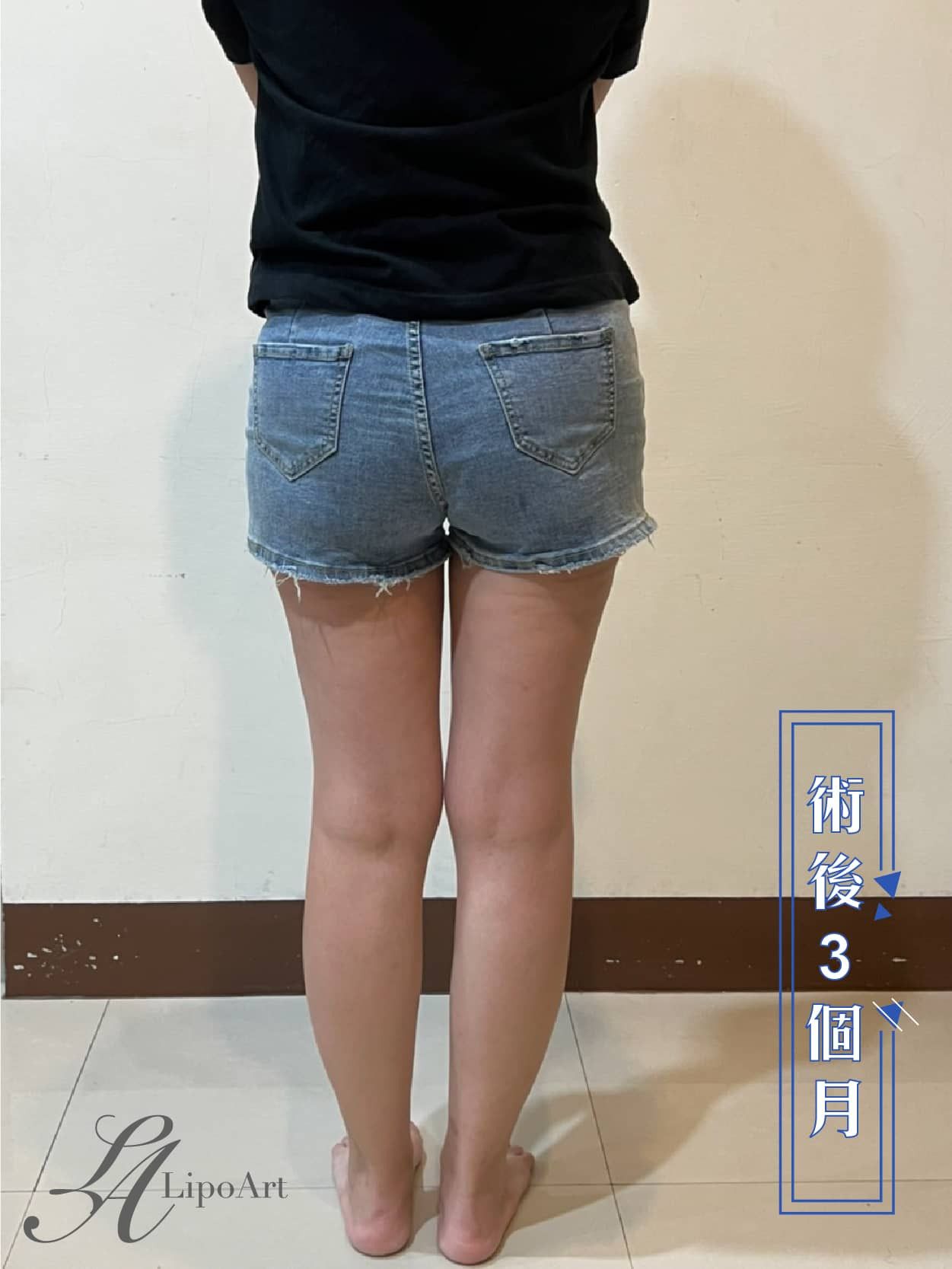 萊波亞
