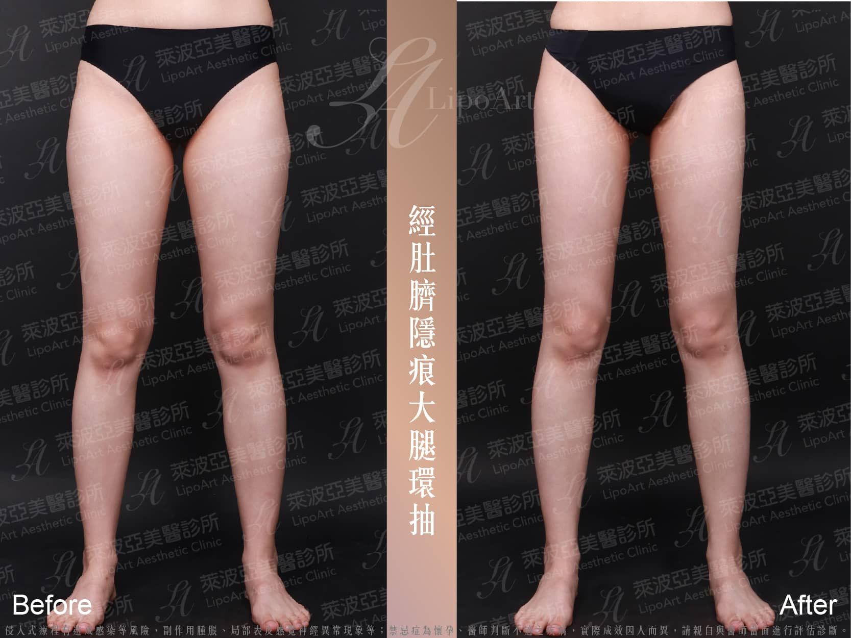 萊波亞