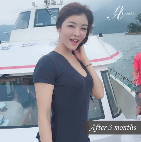 萊波亞