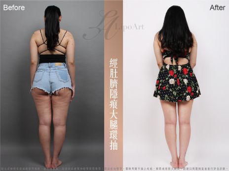 萊波亞 
