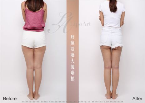 萊波亞 
