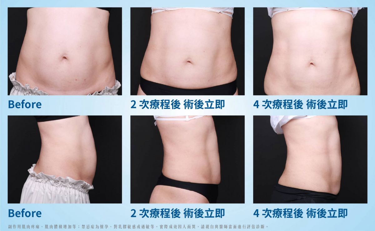 萊波亞
