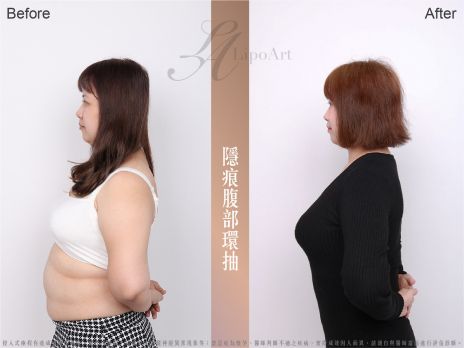 萊波亞