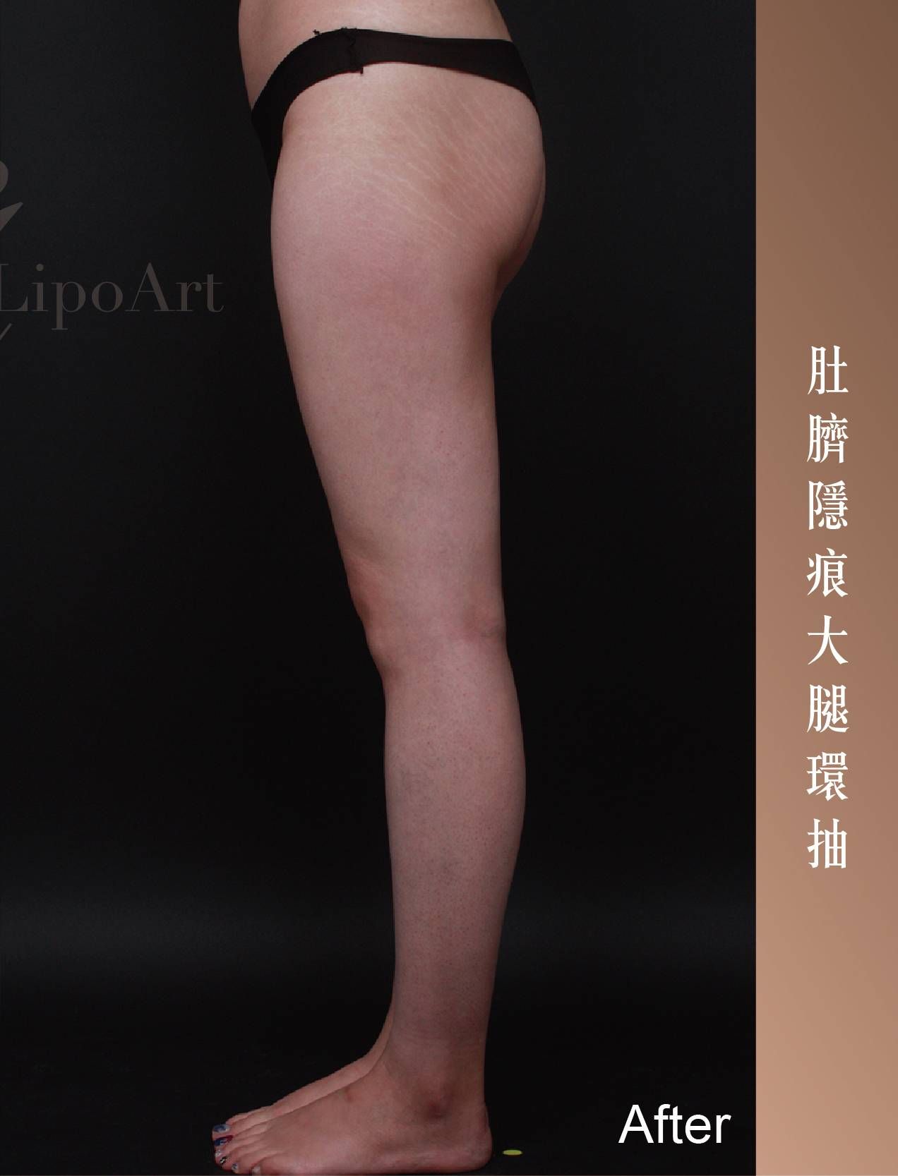 萊波亞 
