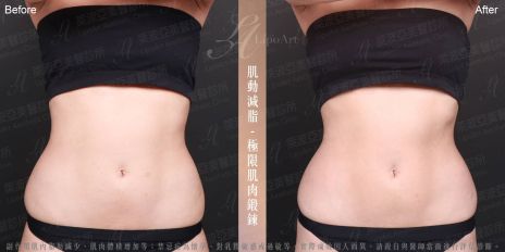 萊波亞