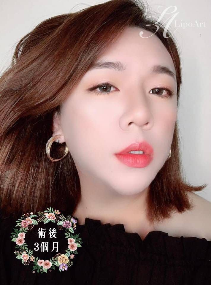 萊波亞
