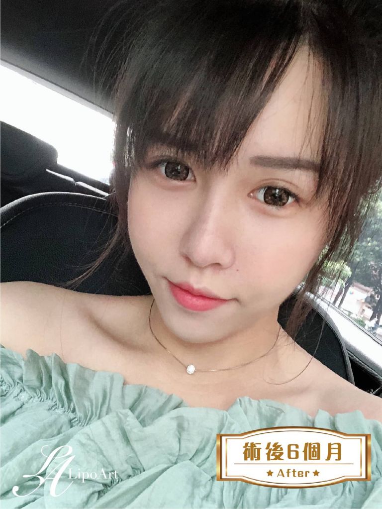 萊波亞