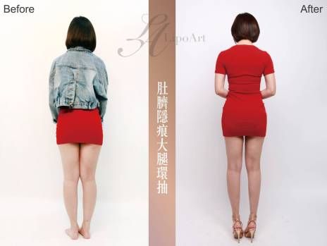 萊波亞 