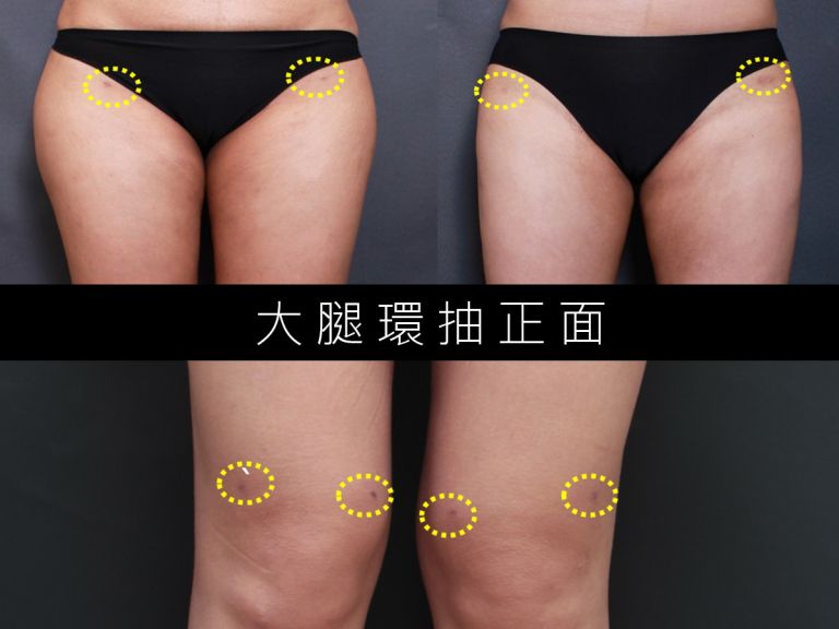 萊波亞