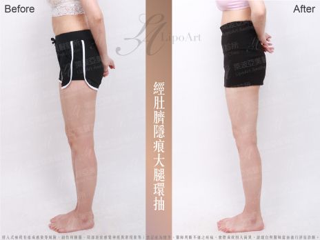 萊波亞