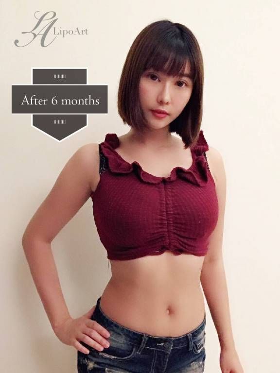 萊波亞