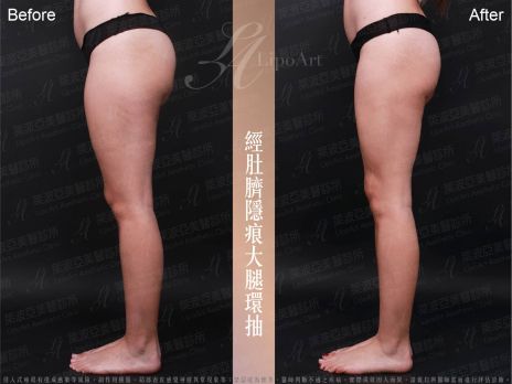 萊波亞 