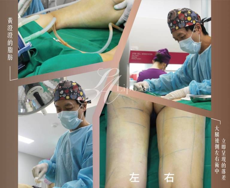 萊波亞