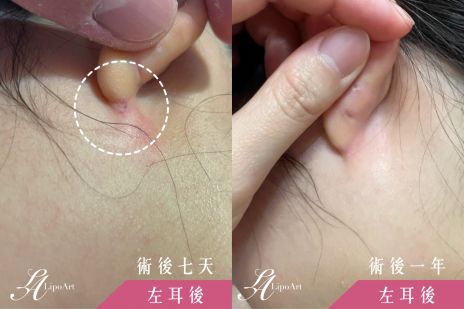 萊波亞