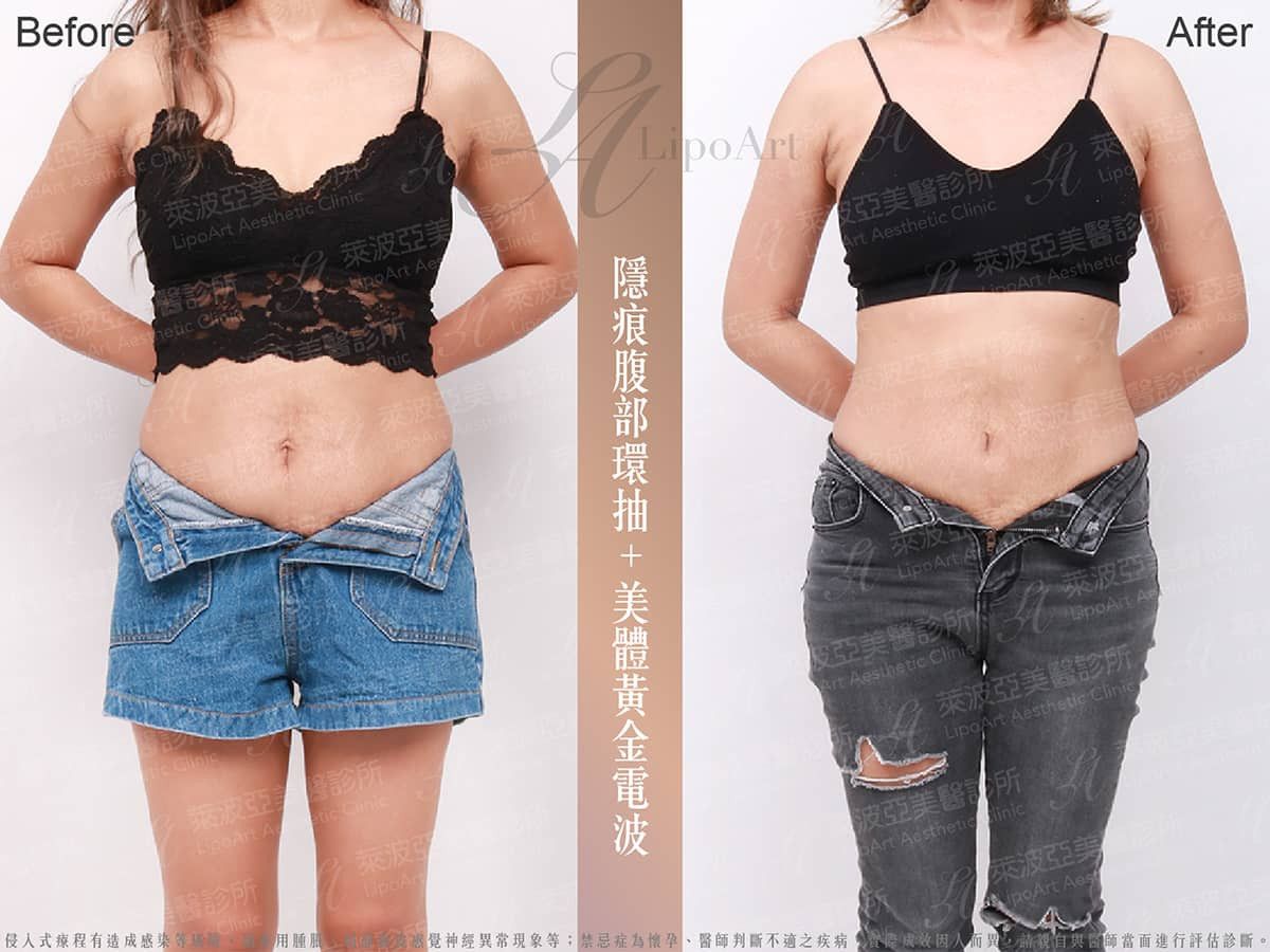 萊波亞