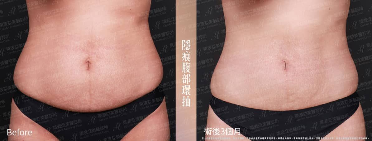 萊波亞