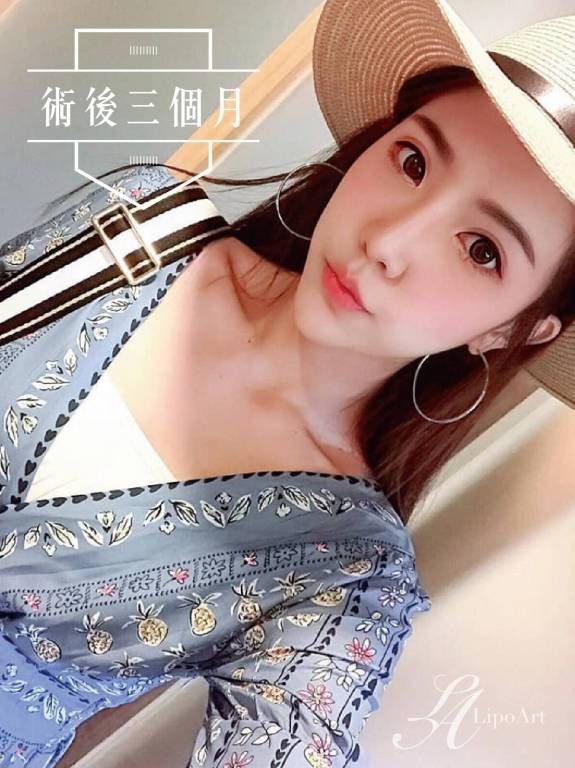 萊波亞
