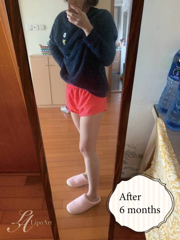 萊波亞