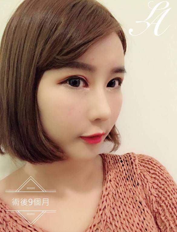 萊波亞