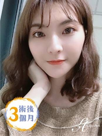 萊波亞