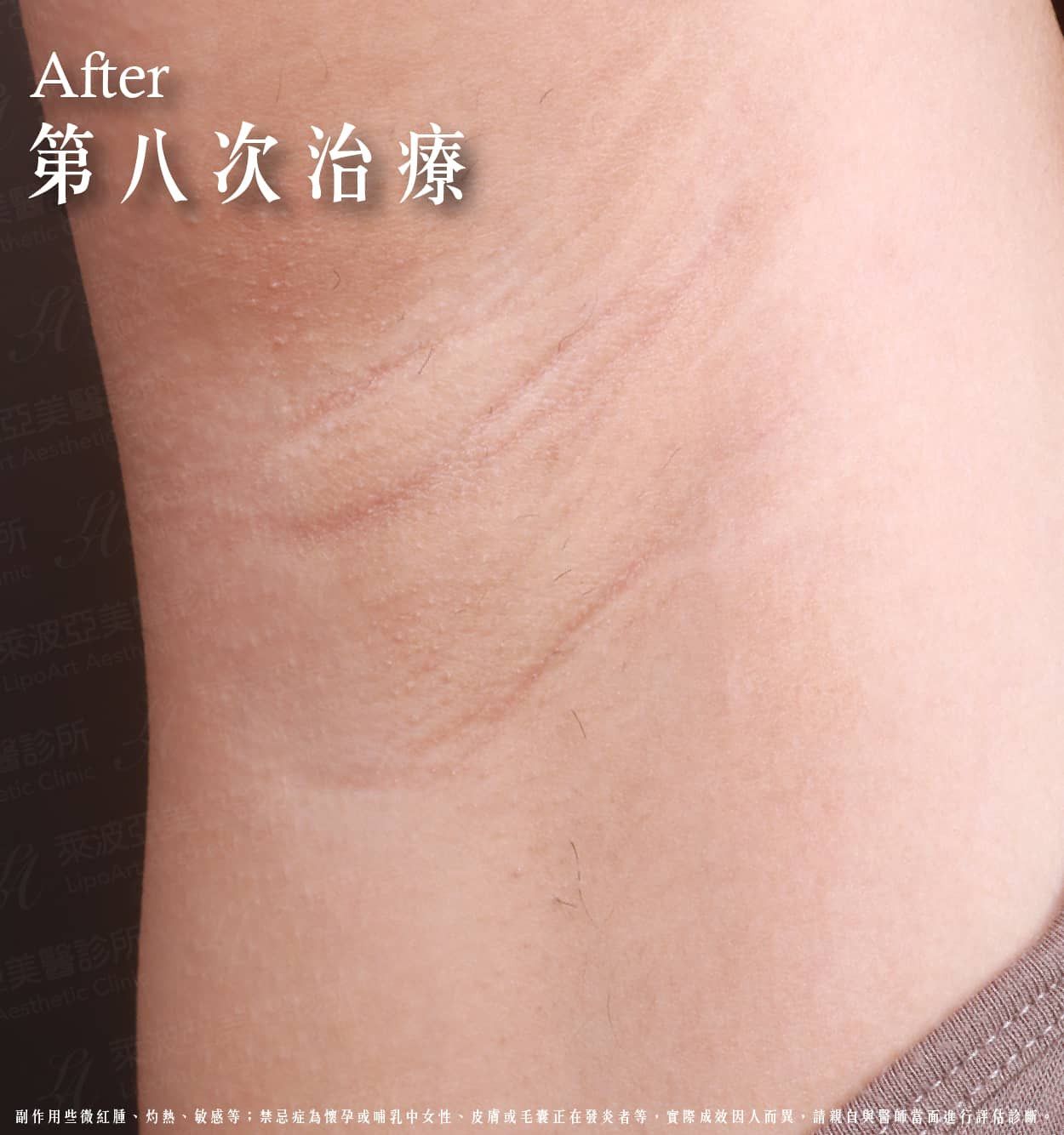 萊波亞